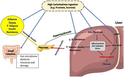 Metabolic-associated fatty liver disease: a selective review of pathogenesis, diagnostic approaches, and therapeutic strategies